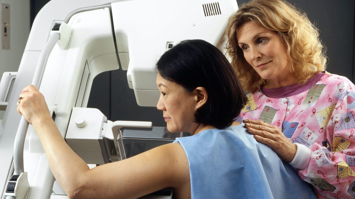 Breast cancer screening levels bounce back after initial pandemic blip